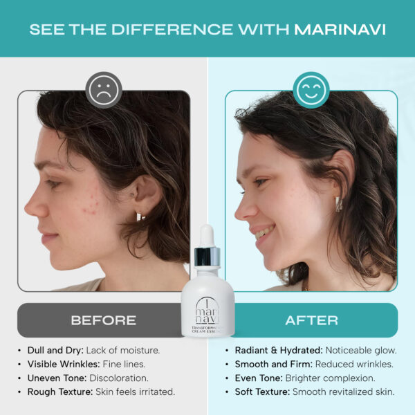 Marinavi Transformation Cream Essence - Image 4