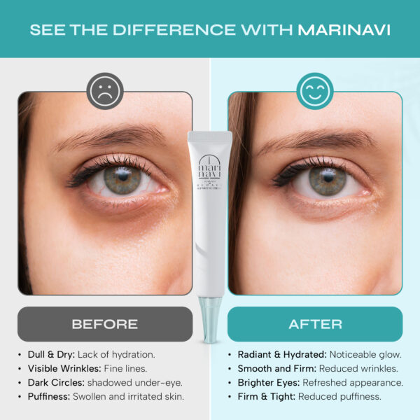 Marinavi Anti Aging Advanced Eye Repair Cream - Image 4